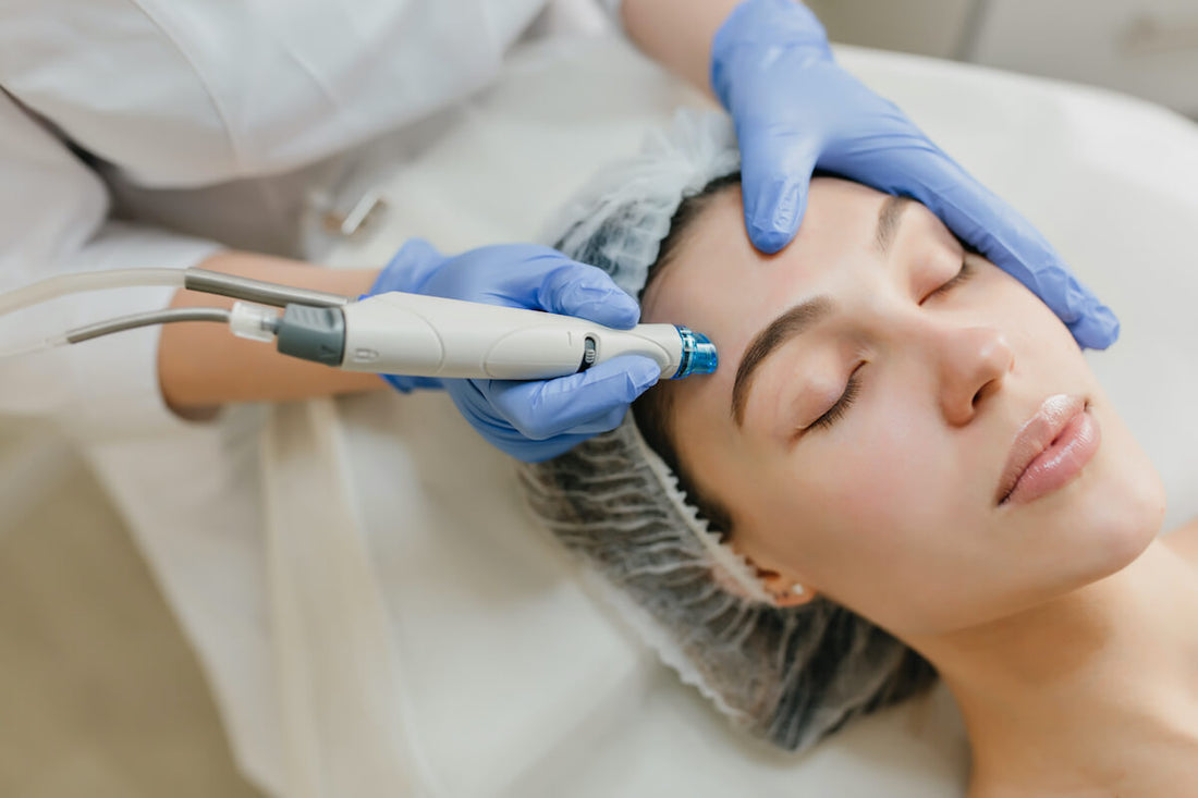 Needling: cos'è, tipologie e benefici per la pelle